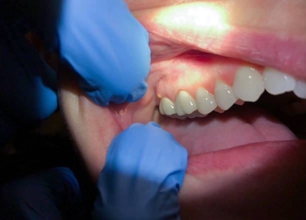 Best Emergency Dental Care for Trauma or Injury in Frazer, PA